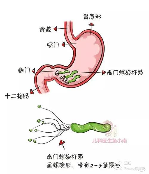 幽门螺旋杆菌是存在于胃及十二指肠球部的一种螺旋状细菌,是一种螺旋